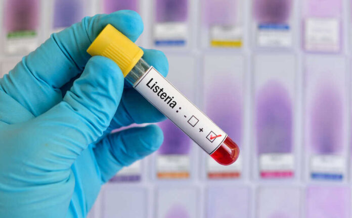 shutterstock_1041103306.jpg featured image Listeria positive test tube