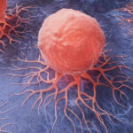 TB Surging in U.S. — Learn the TRUTH About Why! Cancer cells spreading on a blue surface