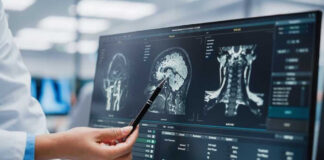 Doctor pointing at brain scans on a computer screen.