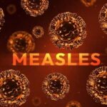 Deadly Measles Surge Triggers Panic Illustration of measles virus particles with the word 'MEASLES' in bold