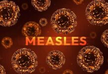Illustration of measles virus particles with the word 'MEASLES' in bold