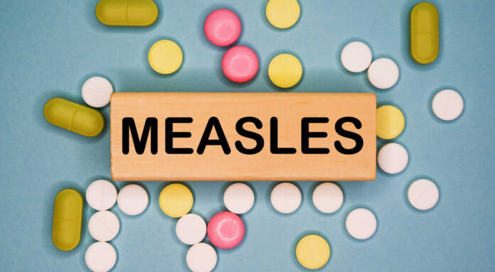 Measles,Written,On,Wooden,Block,On,A,Blue,Background,Among Wooden block with the word 'MEASLES' surrounded by various pills